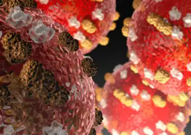 Image of a microscopic view of the Measles Virus